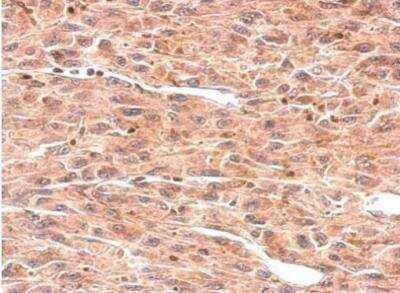 Immunohistochemistry-Paraffin: Osteoadherin/OSAD/OMD Antibody [NBP2-19626]