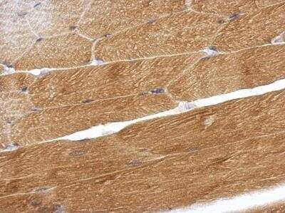 Immunohistochemistry-Paraffin: Osteoadherin/OSAD/OMD Antibody [NBP2-19626]