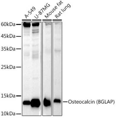 Western Blot: Osteocalcin Antibody (2T1J7) [NBP3-16081]