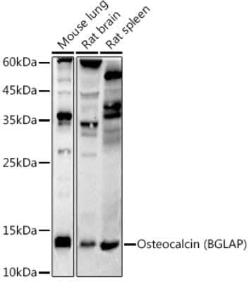 Western Blot: Osteocalcin Antibody (2T1J7) [NBP3-16081]