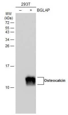 Western Blot: Osteocalcin Antibody [NBP3-13133]