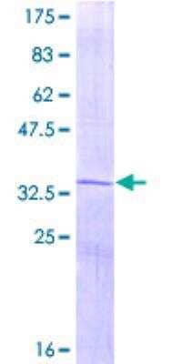 SDS-PAGE: Recombinant Human Osteocalcin GST (N-Term) Protein [H00000632-P01]