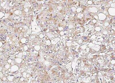 Immunohistochemistry-Paraffin: Osteopontin/OPN Antibody (001) [NBP2-89443]