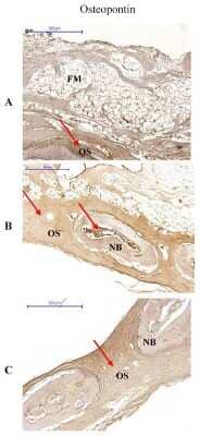 Immunohistochemistry: Osteopontin/OPN Antibody (1B20) - BSA Free [NB110-89062]