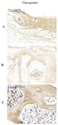 Immunohistochemistry: Osteopontin/OPN Antibody (1B20) - BSA Free [NB110-89062]