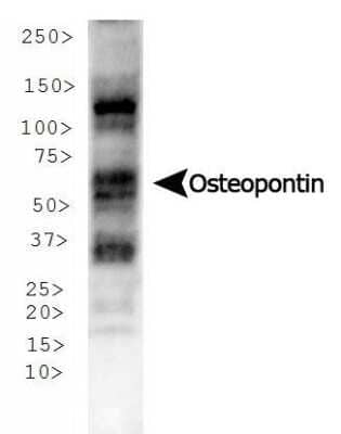 Western Blot: Osteopontin/OPN Antibody (1B20)BSA Free [NB110-89062]