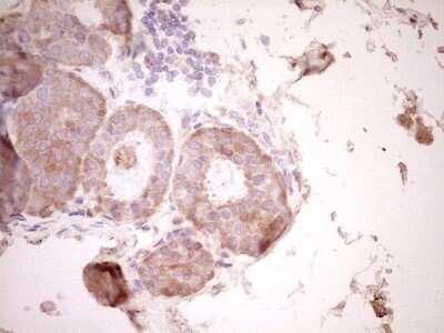Immunohistochemistry: Osteopontin/OPN Antibody (OTI5E4) [NBP2-45954]