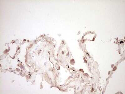 Immunohistochemistry: Osteopontin/OPN Antibody (OTI5E4) [NBP2-45954]