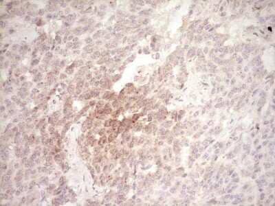 Immunohistochemistry: Osteopontin/OPN Antibody (OTI5E4) [NBP2-45954]