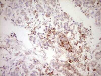 Immunohistochemistry: Osteopontin/OPN Antibody (OTI5E4) [NBP2-45954]
