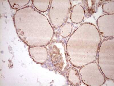 Immunohistochemistry: Osteopontin/OPN Antibody (OTI5E4) [NBP2-45954]