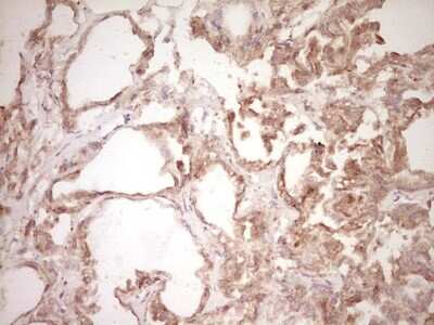 Immunohistochemistry: Osteopontin/OPN Antibody (OTI5E4) [NBP2-45954]