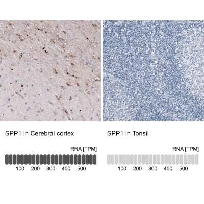 Immunohistochemistry-Paraffin: Osteopontin/OPN Antibody (CL10686) [NBP3-07980]