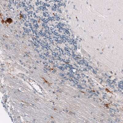 Immunohistochemistry-Paraffin: Osteopontin/OPN Antibody (CL10686) [NBP3-07980]