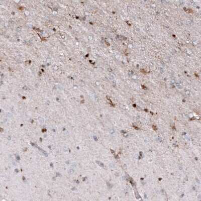 Immunohistochemistry-Paraffin: Osteopontin/OPN Antibody (CL10686) [NBP3-07980]