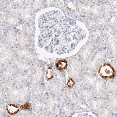 Immunohistochemistry-Paraffin: Osteopontin/OPN Antibody (CL10686) [NBP3-07980]