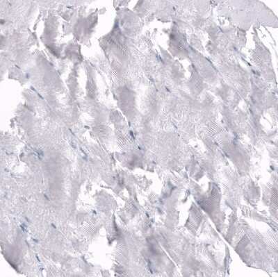 Immunohistochemistry-Paraffin: Osteopontin/OPN Antibody (CL10686) [NBP3-07980]