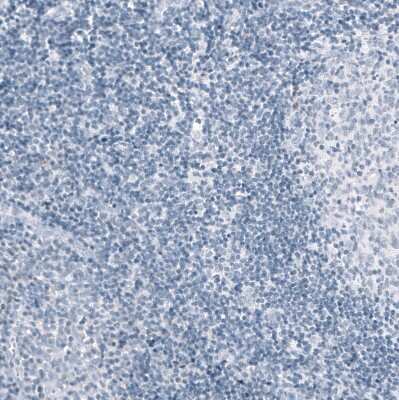 Immunohistochemistry-Paraffin: Osteopontin/OPN Antibody (CL10686) [NBP3-07980]