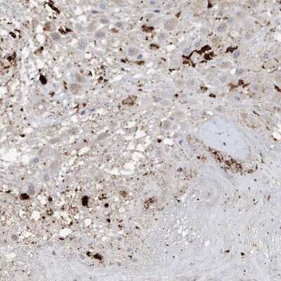 Immunohistochemistry-Paraffin: Osteopontin/OPN Antibody [NBP1-89952]