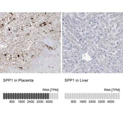 Immunohistochemistry-Paraffin: Osteopontin/OPN Antibody [NBP1-89952]