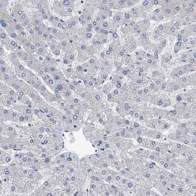 Immunohistochemistry-Paraffin: Osteopontin/OPN Antibody [NBP1-89952]
