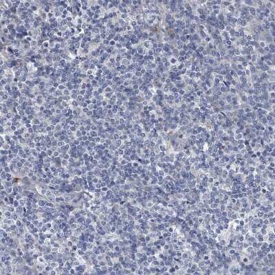 Immunohistochemistry-Paraffin: Osteopontin/OPN Antibody [NBP1-89952]