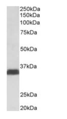 Western Blot: Osteopontin/OPN Antibody [NB100-1883]