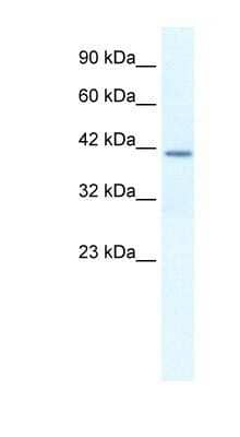 Western Blot: Osteopontin/OPN Antibody [NBP1-59190]