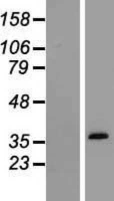 Western Blot: Osteopontin/OPN Overexpression Lysate [NBL1-16425]