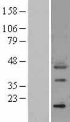 Western Blot: Osteopontin/OPN Overexpression Lysate [NBP2-04188]