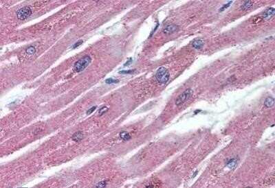 Immunohistochemistry: Osteoprotegerin/TNFRSF11B Antibody (98A1071) - Azide Free [NBP2-33211]