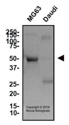 Western Blot: Osteoprotegerin/TNFRSF11B Antibody (98A1071)Azide Free [NBP2-33211]