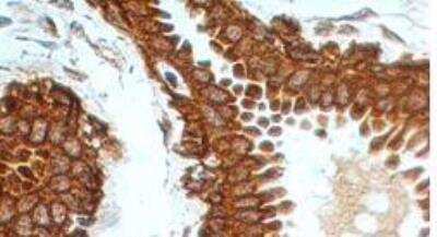 Immunohistochemistry-Paraffin: Osteoprotegerin/TNFRSF11B Antibody (98A1071) - BSA Free [NB100-56505]
