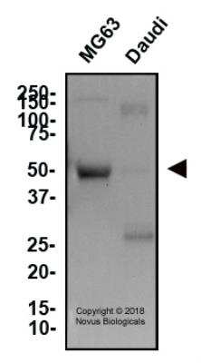 Western Blot: Osteoprotegerin/TNFRSF11B Antibody (98A1071)BSA Free [NB100-56505]