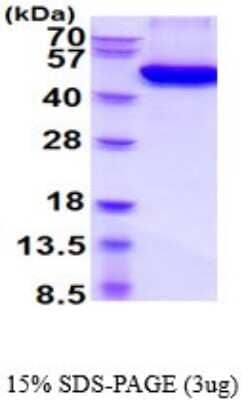 SDS-PAGE: Recombinant Mouse Osteoprotegerin/TNFRSF11B His Protein [NBP2-52350]