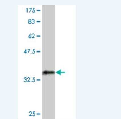 Western Blot: Osterix/Sp7 Antibody (1C11) [H00121340-M03]