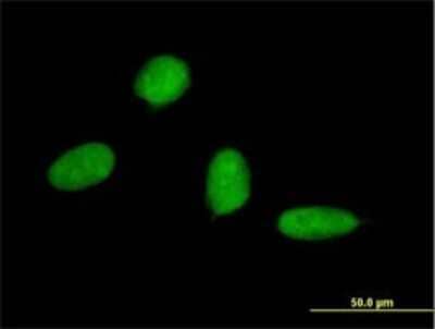 Immunocytochemistry/ Immunofluorescence: Osterix/Sp7 Antibody (2G6) [H00121340-M01]