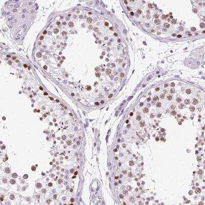 Immunohistochemistry-Paraffin: Osterix/Sp7 Antibody [NBP2-38019]