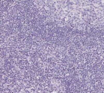 Immunohistochemistry-Paraffin: Osterix/Sp7 Antibody [NBP2-38019]