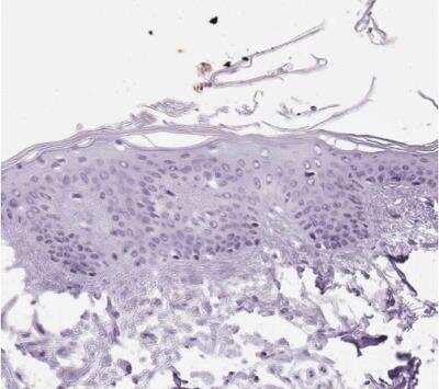 Immunohistochemistry-Paraffin: Osterix/Sp7 Antibody [NBP2-38019]