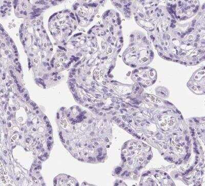 Immunohistochemistry-Paraffin: Osterix/Sp7 Antibody [NBP2-38019]