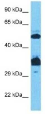 Western Blot: Osterix/Sp7 Antibody [NBP3-10908]