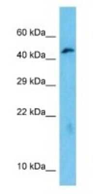 Western Blot: Otoconin 90 Antibody [NBP3-09450]