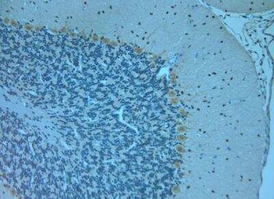 Immunohistochemistry-Paraffin: Otoferlin Antibody [NBP1-46574]