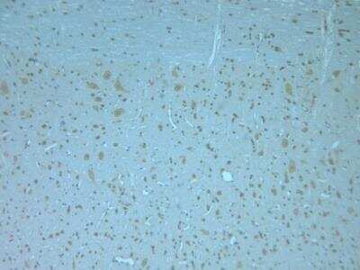 Immunohistochemistry-Paraffin: Otoferlin Antibody [NBP1-46574]