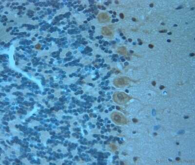 Immunohistochemistry-Paraffin: Otoferlin Antibody [NBP1-46574]