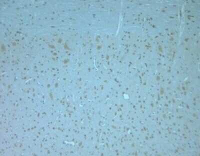 Immunohistochemistry-Paraffin: Otoferlin Antibody [NBP1-46574]