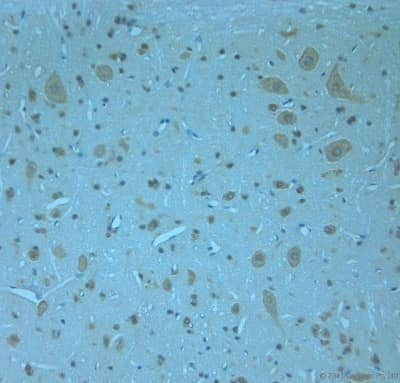 Immunohistochemistry-Paraffin: Otoferlin Antibody [NBP1-46574]