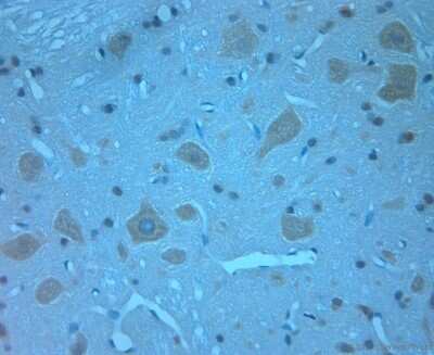 Immunohistochemistry-Paraffin: Otoferlin Antibody [NBP1-46574]