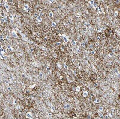 Immunohistochemistry-Paraffin: Otoferlin Antibody [NBP1-85233]